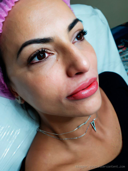Quem não pode fazer a micropigmentação labial?