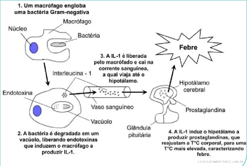 Como é a febre bacteriana?