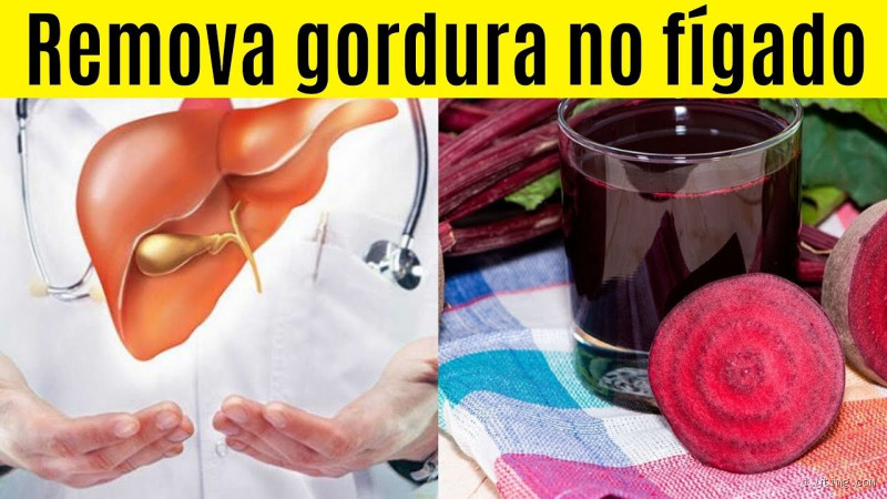 Como eliminar gordura no fígado de forma natural? Descubra agora!