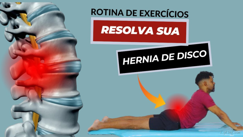 Como fortalecer a coluna lombar com hérnia de disco?