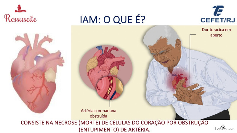 Como salvar alguém de um infarto?