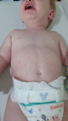 Onde fica a bolinha do bebê na barriga?
