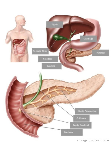 Onde se localiza a dor da pancreatite? Saiba identificar os sinais