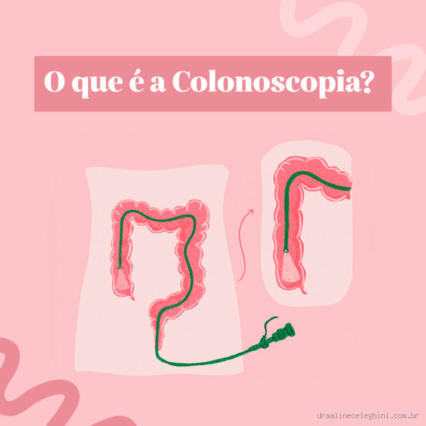 Pode fazer colonoscopia sem evacuar? Entenda tudo sobre o preparo