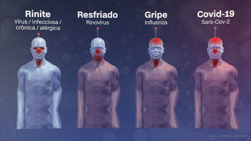 Por que o frio causa sinusite? Entenda a relação entre clima e saúde