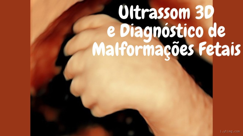 Qual ultrassom detecta malformação? Descubra já!