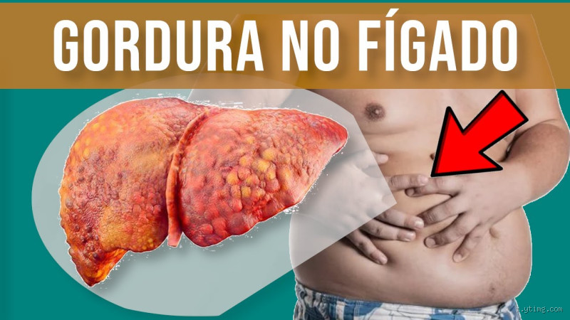 Quem tem gordura no fígado precisa emagrecer? Descubra a resposta!