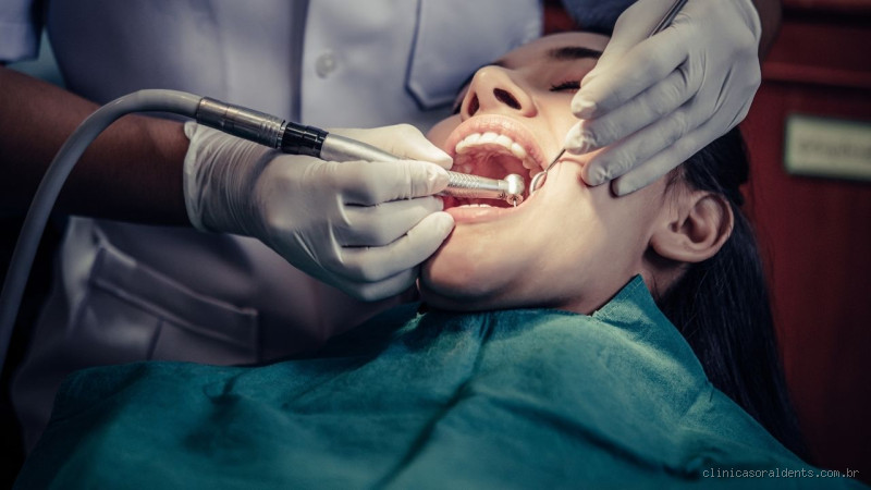 O que fazer para endurecer a raiz do dente? Dicas essenciais para a saúde dental