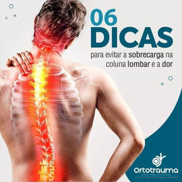 Quantos Banhos de Ouro Tem a Rommanel? Descubra o Segredo da Qualidade!