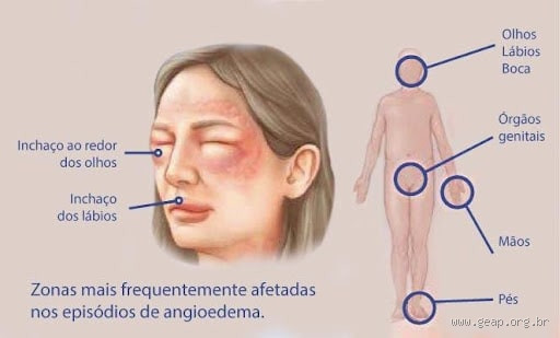 O que causa alergia na pele do nada? Entenda os gatilhos invisíveis