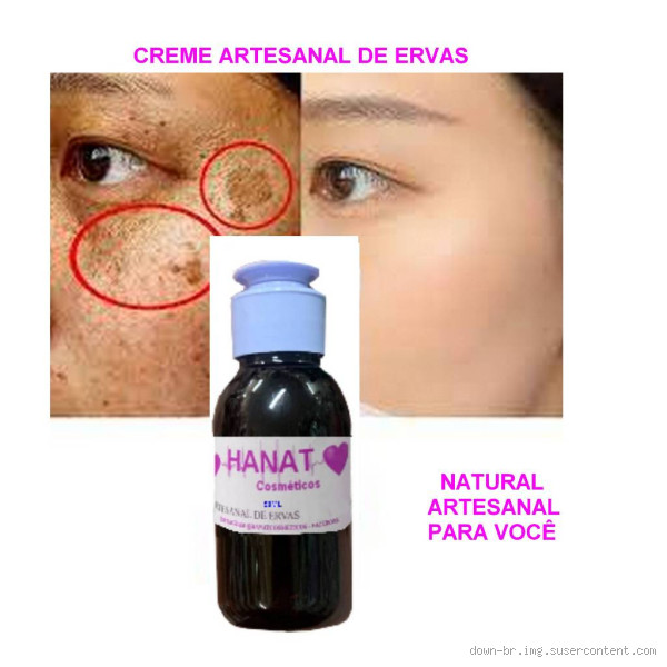 Qual o melhor produto natural para tirar manchas do rosto? Descubra agora!
