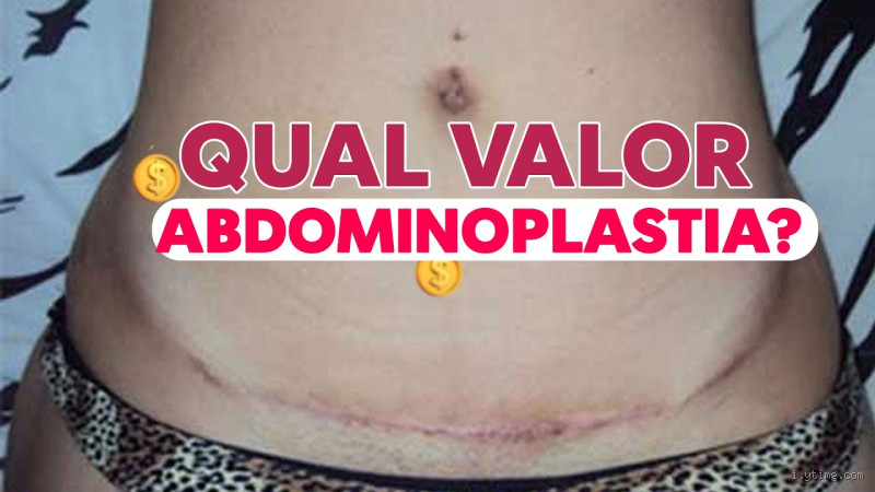 Qual o valor de uma abdominoplastia a laser?