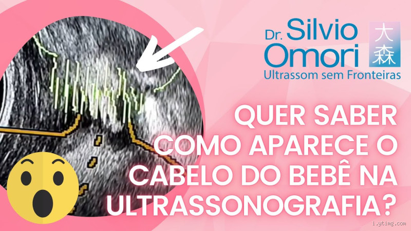 Será que Você Pode Ver Cabelo do Bebê na Ultrassonografia? Saiba Como!